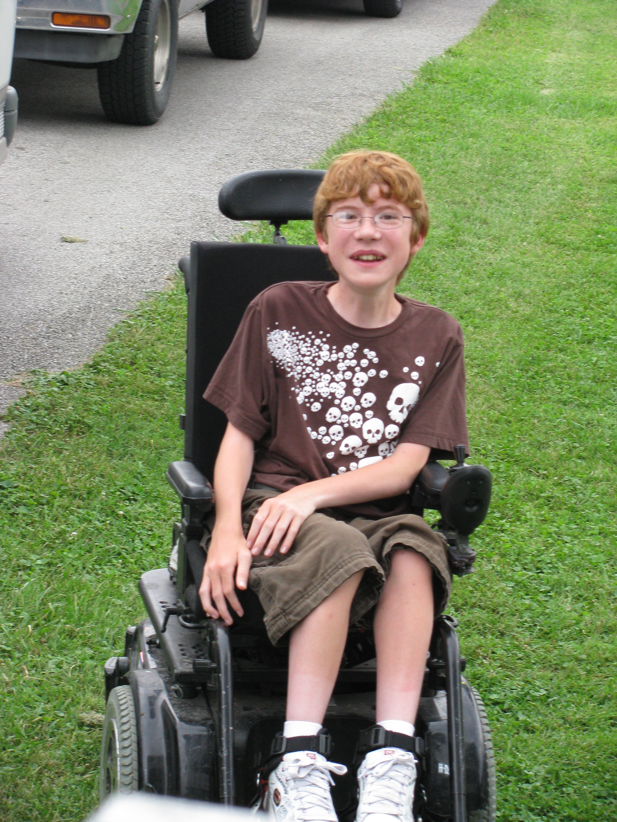 Drew before his spinal fusion surgery at Shriners